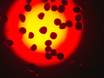 Imagen de grupo de cistos de artemia tomadas bajo el microscopio .Me recuerda a meteoritos en el espacio 